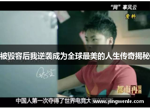 被毁容后我逆袭成为全球最美的人生传奇揭秘